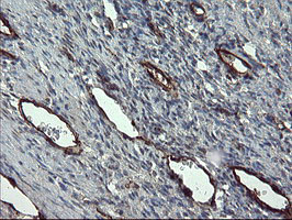 PECAM-1 / CD31 Antibody - IHC of paraffin-embedded Human Ovary tissue using anti-PECAM1 mouse monoclonal antibody.