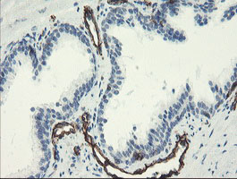 PECAM-1 / CD31 Antibody - IHC of paraffin-embedded Human prostate tissue using anti-PECAM1 mouse monoclonal antibody. (Heat-induced epitope retrieval by 10mM citric buffer, pH6.0, 100C for 10min).
