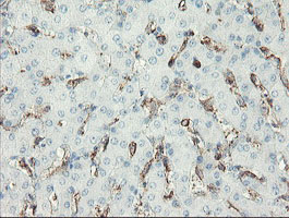 PECAM-1 / CD31 Antibody - IHC of paraffin-embedded Human liver tissue using anti-PECAM1 mouse monoclonal antibody. (Heat-induced epitope retrieval by 10mM citric buffer, pH6.0, 100C for 10min).