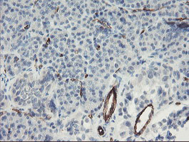 PECAM-1 / CD31 Antibody - IHC of paraffin-embedded Human pancreas tissue using anti-PECAM1 mouse monoclonal antibody. (Heat-induced epitope retrieval by 10mM citric buffer, pH6.0, 100C for 10min).