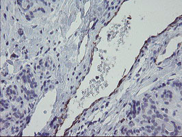 PECAM-1 / CD31 Antibody - IHC of paraffin-embedded Human breast tissue using anti-PECAM1 mouse monoclonal antibody.