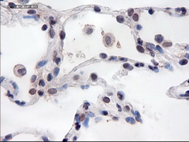 PECAM-1 / CD31 Antibody - IHC of paraffin-embedded lung using anti-PECAM1 mouse monoclonal antibody.