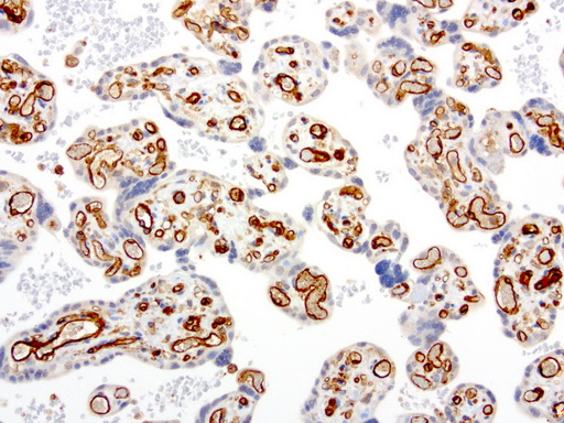 PECAM-1 / CD31 Antibody - Immunohistochemical staining of paraffin-embedded human placenta using anti-PECAM clone UMAB31 mouse monoclonal antibody  at 1:100 with Polink2 Broad HRP DAB detection kit; heat-induced epitope retrieval with GBI Citrate pH6.0 HIER buffer using pressure chamber for 3 minutes at 110C. Cytoplasmic and membraneous staining is seen in the endothelia cells and weak staining in the trophoblast.