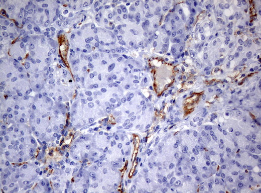 PECAM-1 / CD31 Antibody - Immunohistochemical staining of paraffin-embedded pancreas tissue using anti-PECAM1mouse monoclonal antibody. (Clone UMAB31, dilution 1:100; heat-induced epitope retrieval by 10mM citric buffer, pH6.0, 120C for 3min)