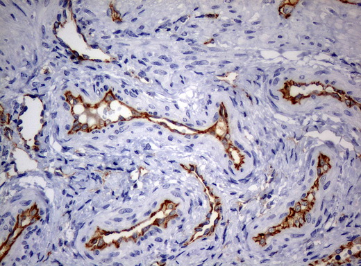 PECAM-1 / CD31 Antibody - Immunohistochemical staining of paraffin-embedded endometrium tissue using anti-PECAM1mouse monoclonal antibody. (Clone UMAB31, dilution 1:100; heat-induced epitope retrieval by 10mM citric buffer, pH6.0, 120C for 3min)