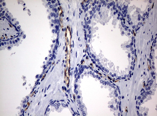 PECAM-1 / CD31 Antibody - Immunohistochemical staining of paraffin-embedded prostate tissue using anti-PECAM1mouse monoclonal antibody. (Clone UMAB31, dilution 1:100; heat-induced epitope retrieval by 10mM citric buffer, pH6.0, 120C for 3min)
