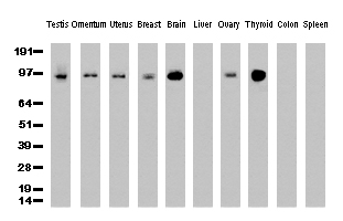 PECAM-1 / CD31 Antibody - Western Blot analysis of 10 different human tissue lysates. (10ug) by using anti-PECAM1 monoclonal antibody. (clone UMAB31, 1:500)