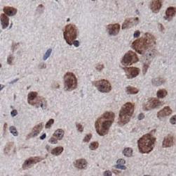 PECAM-1 / CD31 Antibody - CD31 Antibody - IHC of CD31 in mouse brain.  This image was taken for the unconjugated form of this product. Other forms have not been tested.