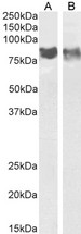 PECAM-1 / CD31 Antibody - Antibody (0.5µg/ml) staining of Mouse (A) and Rat (B) Spleen lysate (35µg protein in RIPA buffer). Detected by chemiluminescence.
