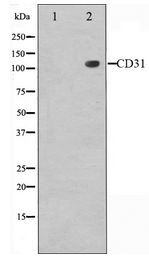 PECAM-1 / CD31 Antibody - Western blot of PECAM-1 expression in Jurkat whole cell lysates,The lane on the left is treated with the antigen-specific peptide.