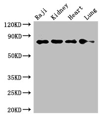 PECAM-1 / CD31 Antibody - Positive WB detected in:Raji whole cell lysate,Mouse kidney tissue,Rat heart tissue,Rat lung tissue;All lanes:PECAM1 antibody at 2.7?g/ml;Secondary;Goat polyclonal to rabbit IgG at 1/50000 dilution;Predicted band size: 83,81,80,82 KDa;Observed band size: 83 KDa;