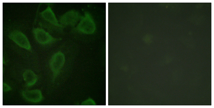 PECAM-1 / CD31 Antibody - Immunofluorescence analysis of HeLa cells, using PECAM-1 (Phospho-Tyr713) Antibody. The picture on the right is blocked with the phospho peptide.