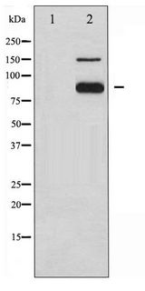 PECAM-1 / CD31 Antibody - Western blot of PECAM-1 phosphorylation expression in Jurkat whole cell lysates,The lane on the left is treated with the antigen-specific peptide.