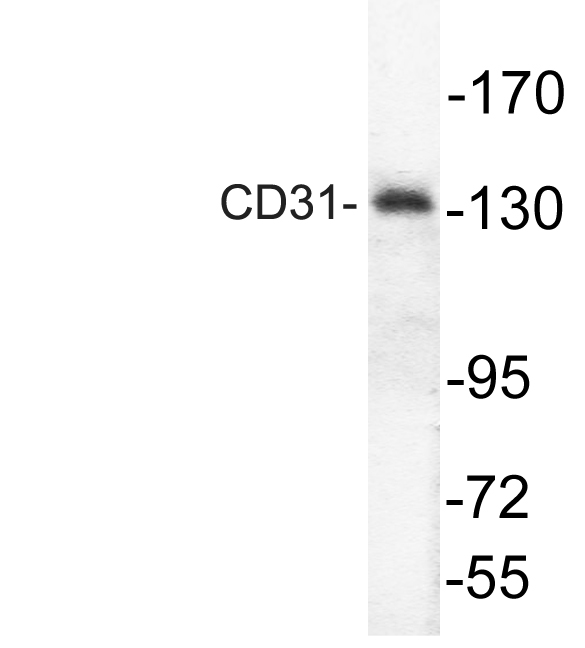 PECAM-1 / CD31 Antibody - Western blot of PECAM-1 (T709) pAb in extracts from Jurkat cells.