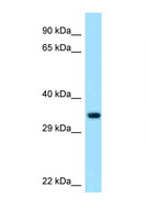 PECR Antibody - PECR antibody Western blot of HCT15 Cell lysate. Antibody concentration 1 ug/ml.  This image was taken for the unconjugated form of this product. Other forms have not been tested.