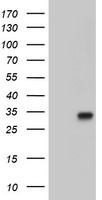 PECR Antibody - HEK293T cells were transfected with the pCMV6-ENTRY control (Left lane) or pCMV6-ENTRY PECR (Right lane) cDNA for 48 hrs and lysed. Equivalent amounts of cell lysates (5 ug per lane) were separated by SDS-PAGE and immunoblotted with anti-PECR.
