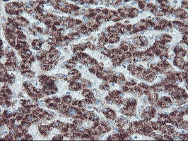 PECR Antibody - IHC of paraffin-embedded Human liver tissue using anti-PECR mouse monoclonal antibody. (Heat-induced epitope retrieval by 10mM citric buffer, pH6.0, 100C for 10min).