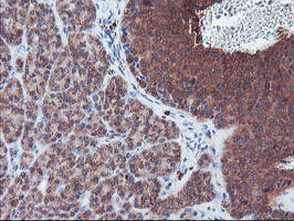 PECR Antibody - IHC of paraffin-embedded Human pancreas tissue using anti-PECR mouse monoclonal antibody. (Heat-induced epitope retrieval by 10mM citric buffer, pH6.0, 100C for 10min).