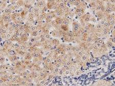 PECR Antibody - IHC of paraffin-embedded Human liver tissue using anti-PECR mouse monoclonal antibody. (Dilution 1:50).