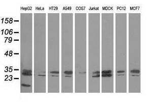 PECR Antibody - Western blot of extracts (35 ug) from 9 different cell lines by using anti-PECR monoclonal antibody.