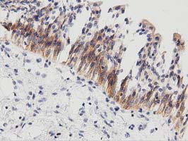 PECR Antibody - IHC of paraffin-embedded Human bladder tissue using anti-PECR mouse monoclonal antibody. (Dilution 1:50).