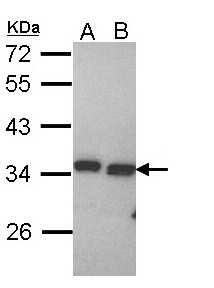 PECR Antibody - Sample (30 ug of whole cell lysate). A: Hela. B: Hep G2. 12% SDS PAGE. PECR antibody diluted at 1:1000. 