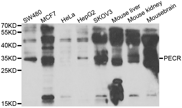 PECR Antibody - Western blot analysis of extracts of various cell lines.