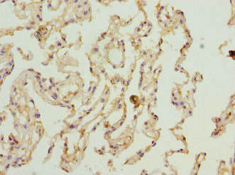 PECR Antibody - Immunohistochemistry of paraffin-embedded human lung tissue at dilution 1:100