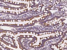 PECR Antibody - Immunochemical staining of human PECR in human duodenum with rabbit polyclonal antibody at 1:100 dilution, formalin-fixed paraffin embedded sections.