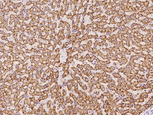 PECR Antibody - Immunochemical staining of human PECR in human liver with rabbit polyclonal antibody at 1:100 dilution, formalin-fixed paraffin embedded sections.