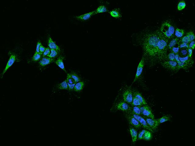 PECR Antibody - Immunofluorescence staining of PECR in A431 cells. Cells were fixed with 4% PFA, permeabilzed with 0.1% Triton X-100 in PBS, blocked with 10% serum, and incubated with rabbit anti-Human PECR polyclonal antibody (dilution ratio 1:200) at 4°C overnight. Then cells were stained with the Alexa Fluor 488-conjugated Goat Anti-rabbit IgG secondary antibody (green) and counterstained with DAPI (blue). Positive staining was localized to Cytoplasm.