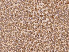 PECR Antibody - Immunochemical staining of human PECR in human liver with rabbit polyclonal antibody at 1:100 dilution, formalin-fixed paraffin embedded sections.