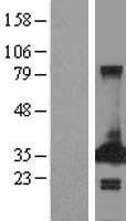 PECR Protein - Western validation with an anti-DDK antibody * L: Control HEK293 lysate R: Over-expression lysate