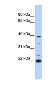 PEF1 Antibody - PEF1 antibody Western blot of 721_B cell lysate. This image was taken for the unconjugated form of this product. Other forms have not been tested.