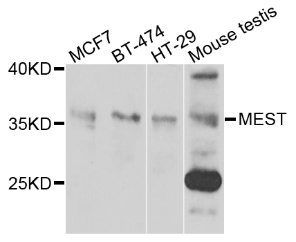 PEG1 / MEST Antibody - Western blot analysis of extracts of various cells.