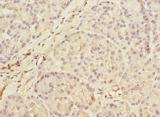 PEG1 / MEST Antibody - Immunohistochemistry of paraffin-embedded human pancreatic tissue at dilution 1:100