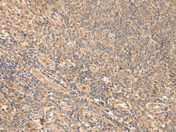 PEG1 / MEST Antibody - Immunohistochemistry of paraffin-embedded Human tonsil tissue  using MEST Polyclonal Antibody at dilution of 1:65(×200)