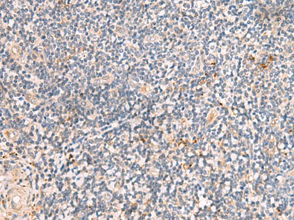 PEG1 / MEST Antibody - Immunohistochemistry of paraffin-embedded Human tonsil tissue  using MEST Polyclonal Antibody at dilution of 1:50(×200)