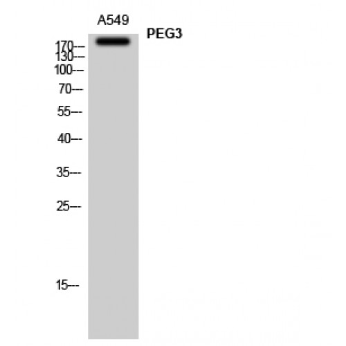 PEG3 Antibody - Western blot of PEG3 antibody