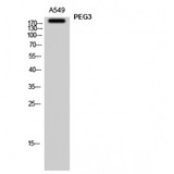 PEG3 Antibody - Western blot of PEG3 antibody