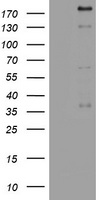 PEG3 Antibody - HEK293T cells were transfected with the pCMV6-ENTRY control (Left lane) or pCMV6-ENTRY ${SYMBOL} (${RC_SKU}, Right lane) cDNA for 48 hrs and lysed. Equivalent amounts of cell lysates (5 ug per lane) were separated by SDS-PAGE and immunoblotted with anti-${SYMBOL}.