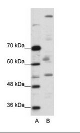 PEG3 Antibody - A: Marker, B: A204 Cell Lysate.  This image was taken for the unconjugated form of this product. Other forms have not been tested.