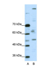 PEG3 Antibody - PEG3 antibody Western blot of A204 cell lysate. This image was taken for the unconjugated form of this product. Other forms have not been tested.