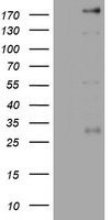 PEG3 Antibody - HEK293T cells were transfected with the pCMV6-ENTRY control (Left lane) or pCMV6-ENTRY PEG3 (Right lane) cDNA for 48 hrs and lysed. Equivalent amounts of cell lysates (5 ug per lane) were separated by SDS-PAGE and immunoblotted with anti-PEG3.