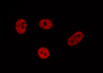 PEG3 Antibody - Staining A549 cells by IF/ICC. The samples were fixed with PFA and permeabilized in 0.1% Triton X-100, then blocked in 10% serum for 45 min at 25°C. The primary antibody was diluted at 1:200 and incubated with the sample for 1 hour at 37°C. An Alexa Fluor 594 conjugated goat anti-rabbit IgG (H+L) Ab, diluted at 1/600, was used as the secondary antibody.