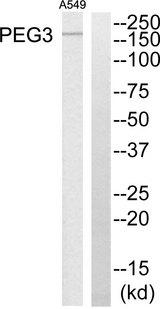 PEG3 Antibody - Western blot analysis of extracts from A549 cells, using PEG3 antibody.