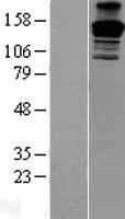 PEG3 Protein - Western validation with an anti-DDK antibody * L: Control HEK293 lysate R: Over-expression lysate