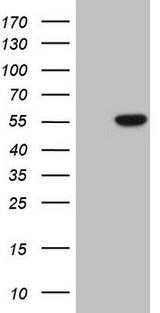 PELI1 / Pellino 1 Antibody - HEK293T cells were transfected with the pCMV6-ENTRY control. (Left lane) or pCMV6-ENTRY PELI1. (Right lane) cDNA for 48 hrs and lysed. Equivalent amounts of cell lysates. (5 ug per lane) were separated by SDS-PAGE and immunoblotted with anti-PELI1. (1:2000)