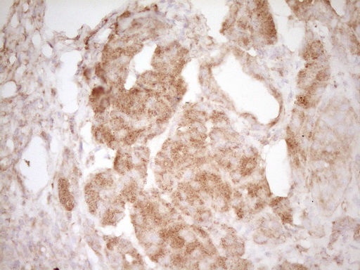 PELI1 / Pellino 1 Antibody - IHC of paraffin-embedded Human pancreas tissue using anti-PELI1 mouse monoclonal antibody. (Heat-induced epitope retrieval by 1 mM EDTA in 10mM Tris, pH8.5, 120°C for 3min).