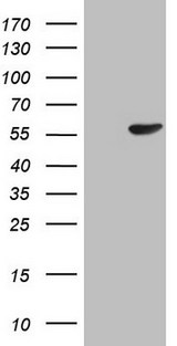 PELI1 / Pellino 1 Antibody - HEK293T cells were transfected with the pCMV6-ENTRY control (Left lane) or pCMV6-ENTRY PELI1 (Right lane) cDNA for 48 hrs and lysed. Equivalent amounts of cell lysates (5 ug per lane) were separated by SDS-PAGE and immunoblotted with anti-PELI1.